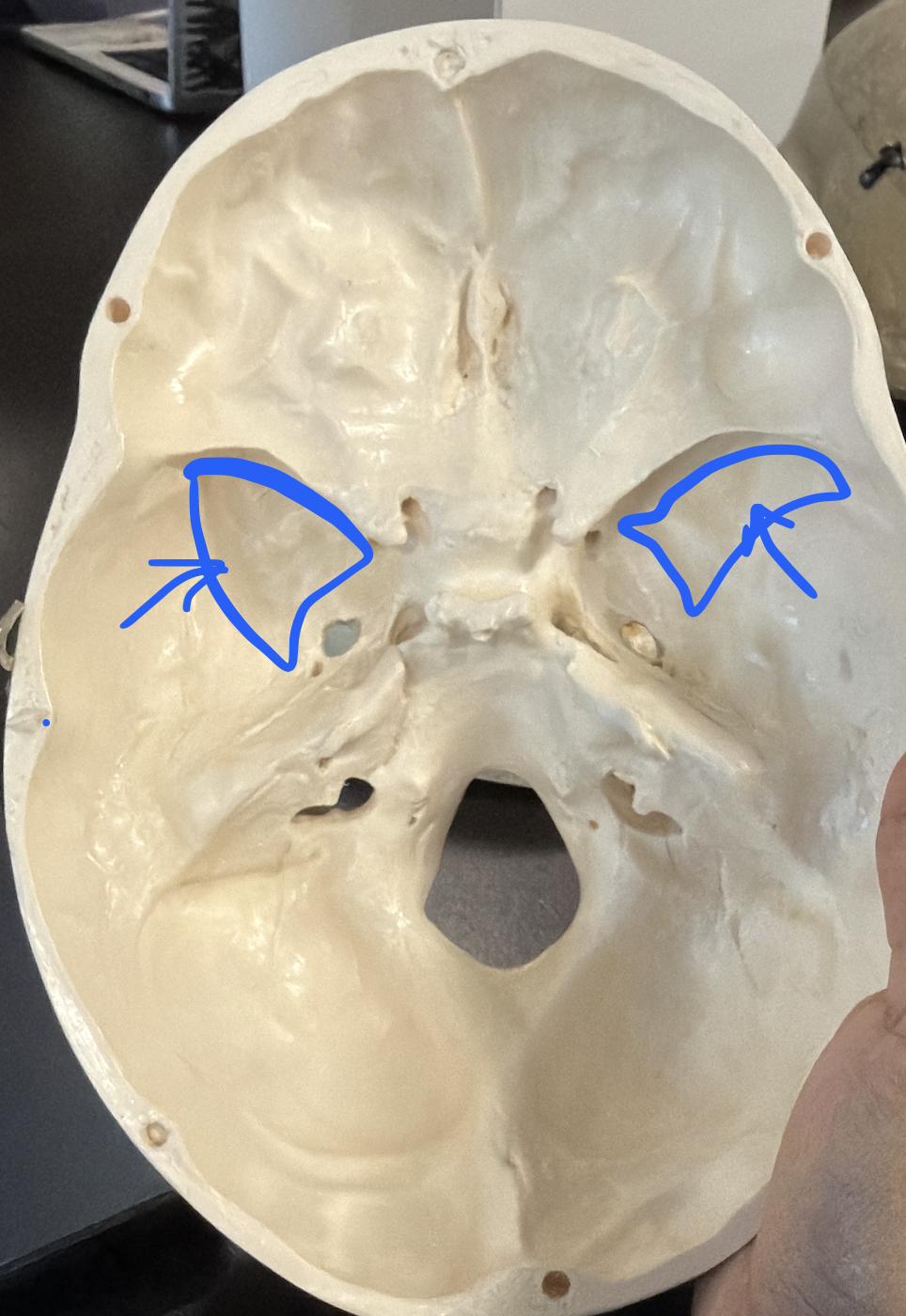 <p>large lateral wings forming part of the cranial floor and eyes</p>