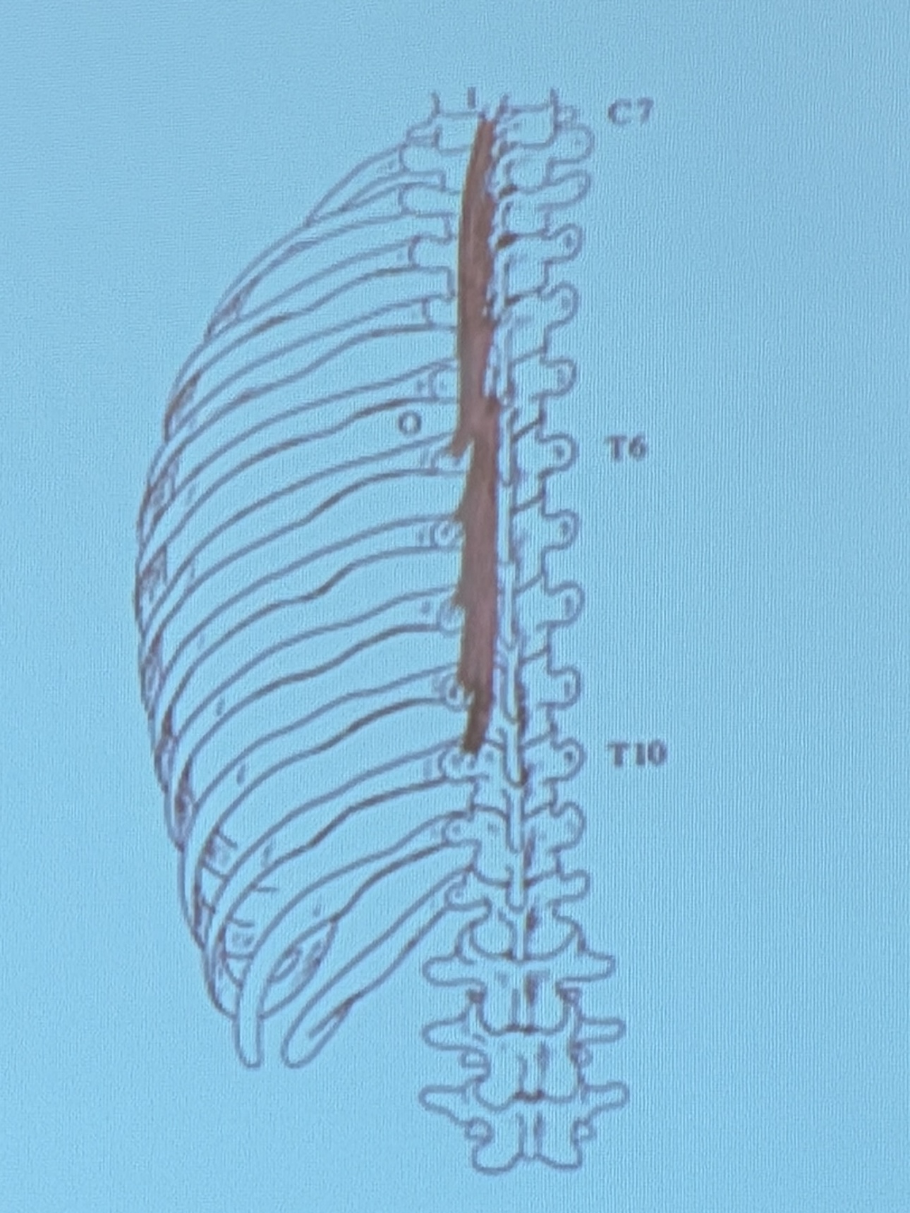 <p>Muscle name?</p>