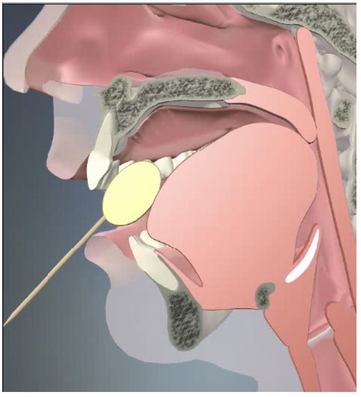 <p>Oral Prep Phase</p>