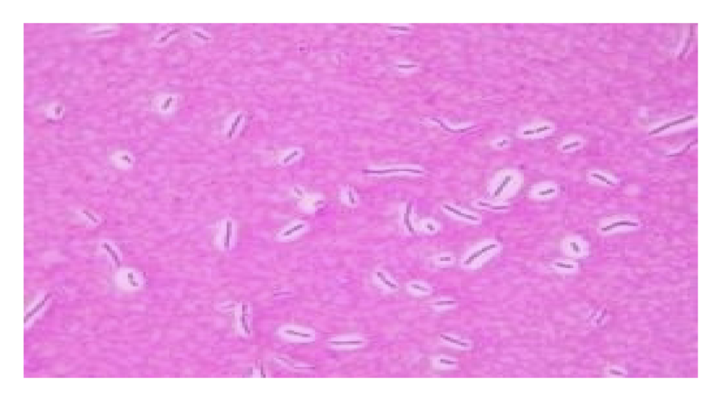 <p>what is this and morphology</p>