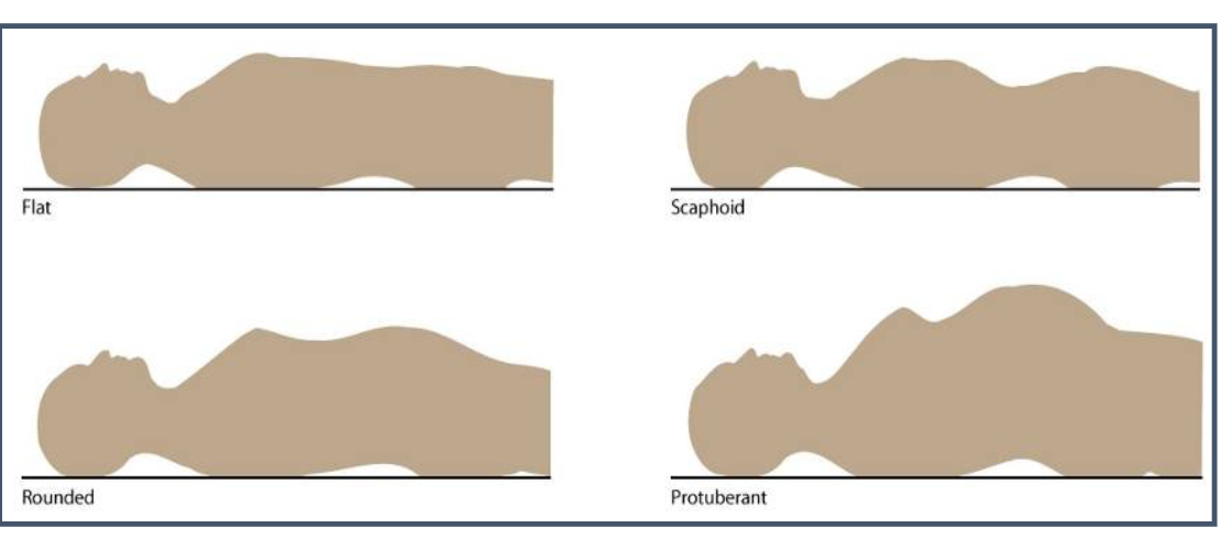 <p>look from above, then stoop lower</p>