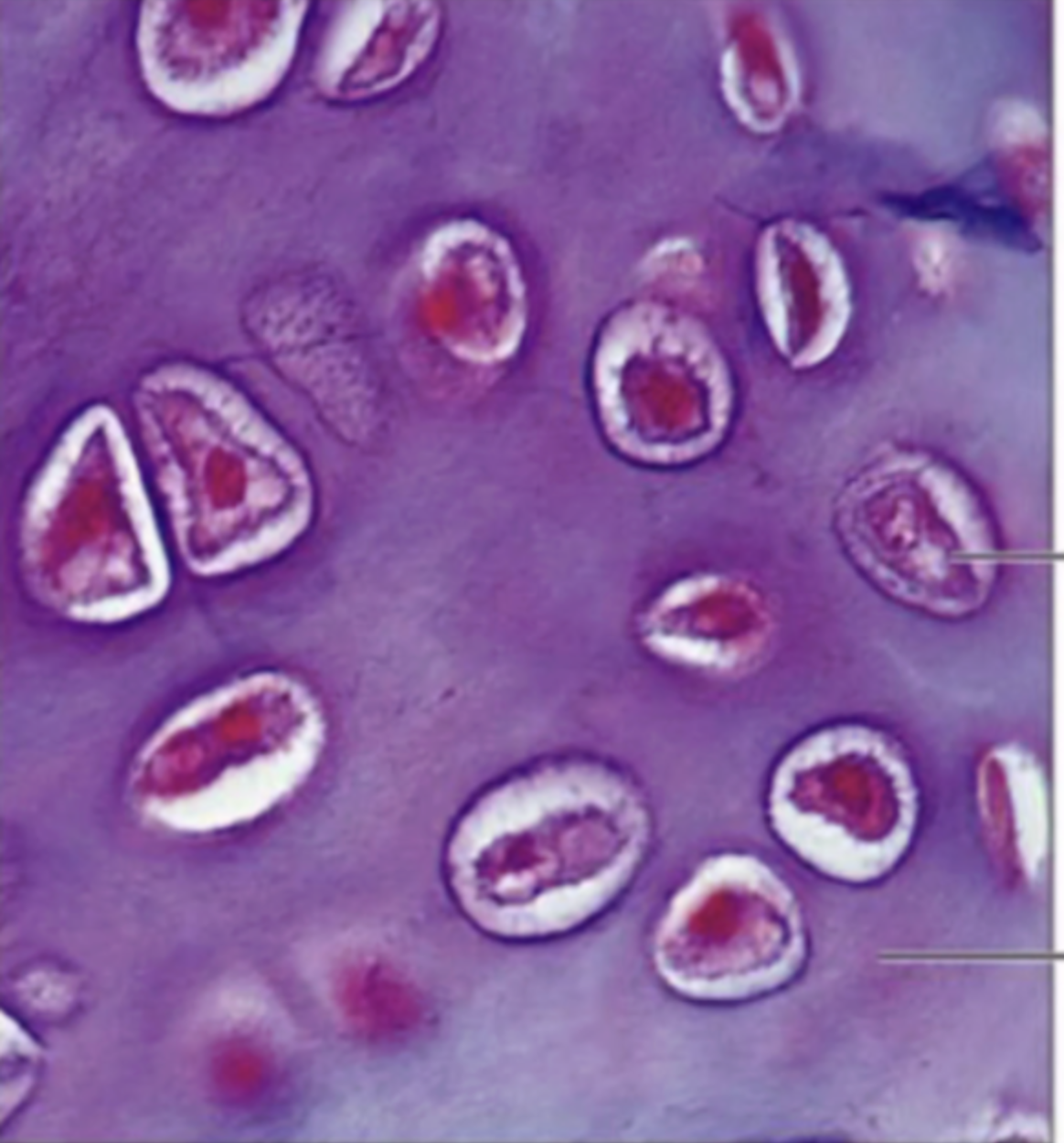 <p><span style="background-color: transparent;">human trachea and hyaline cartilage</span></p>