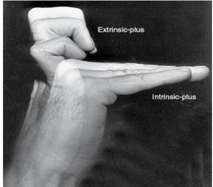 <p>Intrinsics firing and extrinsics silent</p>