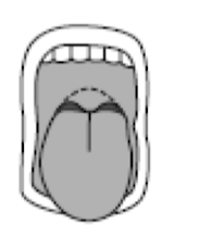 <p>what mallampati score </p>