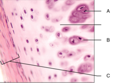 <p>C: membrane of fibrous connective tissue that surrounds the external surface of cartilage</p>