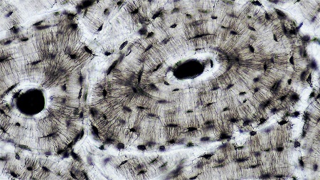 <p>cocentric circles around a central canal, bone cells (osteocytes) surrounded by lacunae, little open space</p>