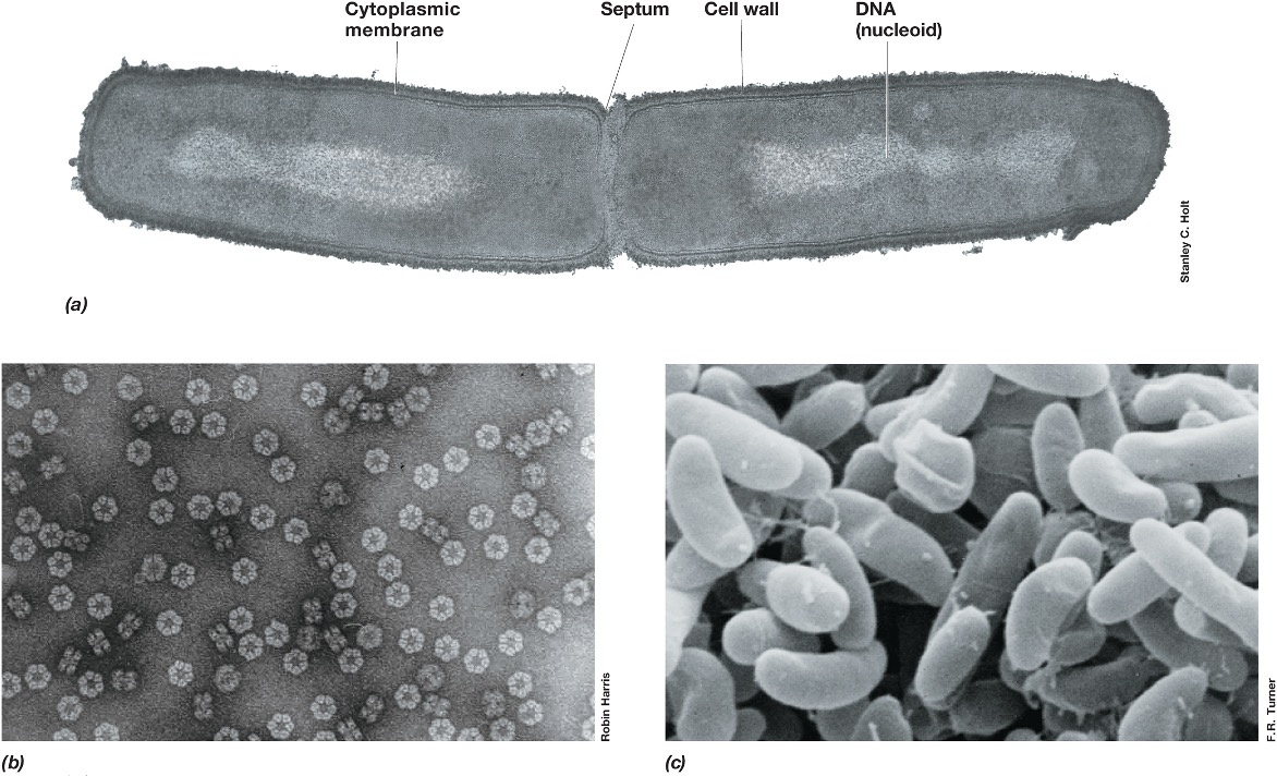 <ul><li><p><em>Much greater resolving power (0.2 n m) than light microscope.</em></p></li><li><p><em>Enables visualization of structures at the molecular level.</em></p></li><li><p><em>Specimen must be very thin (20–60 n m) and stained with high atomic weight substances that scatter electrons well and improve contrast.</em></p></li><li><p><em>Negative staining allows direct observation of intact cells/components. (Figure 1.29b).</em></p></li><li><p><em>Electron cryotomography (cryo E T): T E M used to obtain three-dimensional images.</em></p></li></ul><p></p>