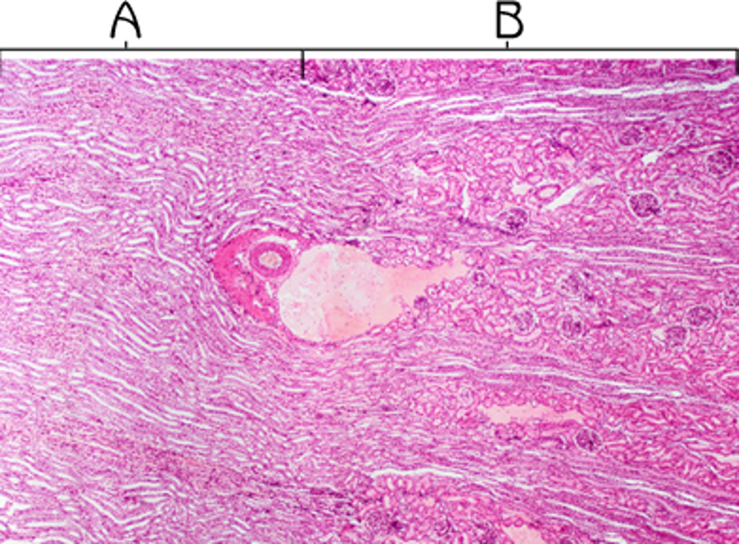 <p>A</p><p>Function: maintain salt and water balance of blood</p>