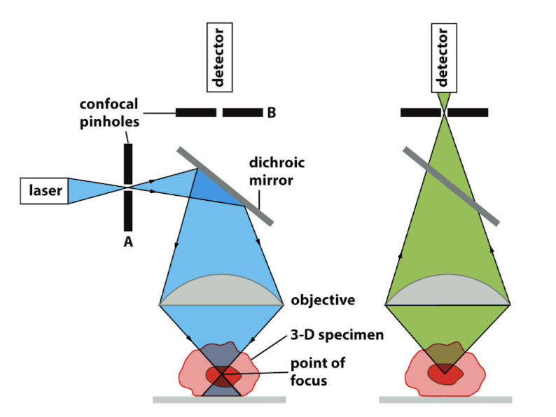 <p>Confocal vs. Widefield microscopy images</p>