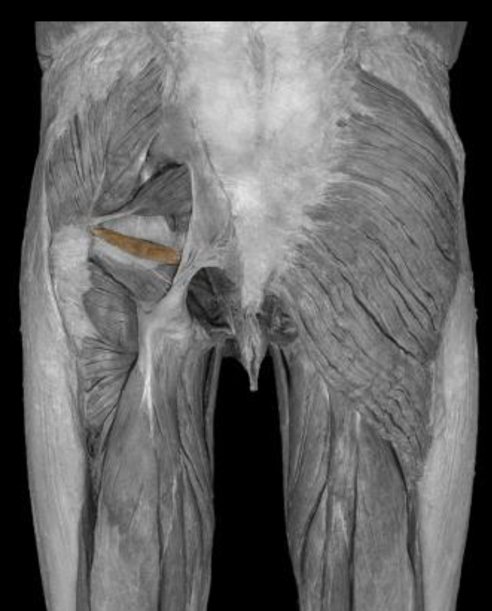 <p>innervation of gemellus superior</p>