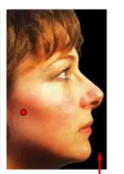 <p>Lift body part up (superiorly)</p>