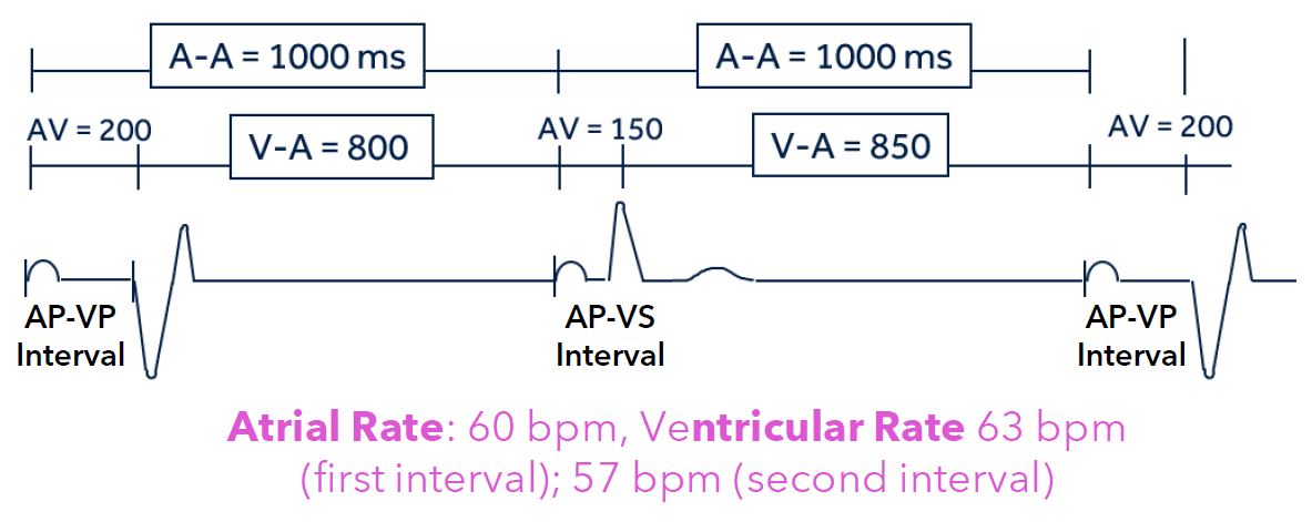 <p>the A-A interval remains constant - <span>Focuses on the interval between two atrial events (paced or sensed).</span></p><p>The V-A interval shortens or lengthens to maintain a constant A-A interval.</p>