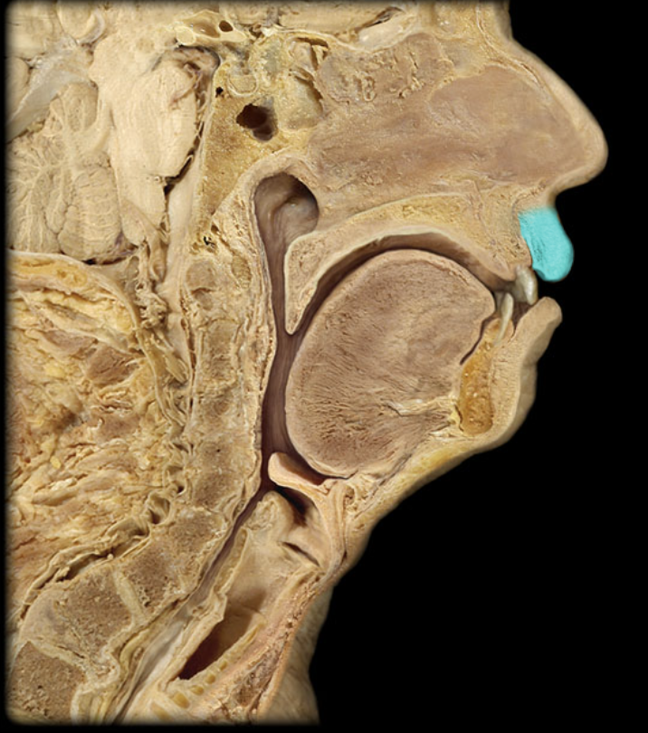 term image