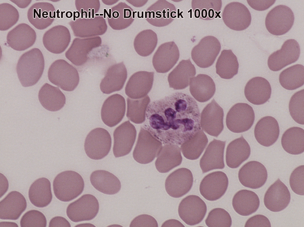 <p><span style="background-color: rgba(0, 0, 0, 0); line-height: 19.55px;">Purple multi-lobed nucleus,</span></p>