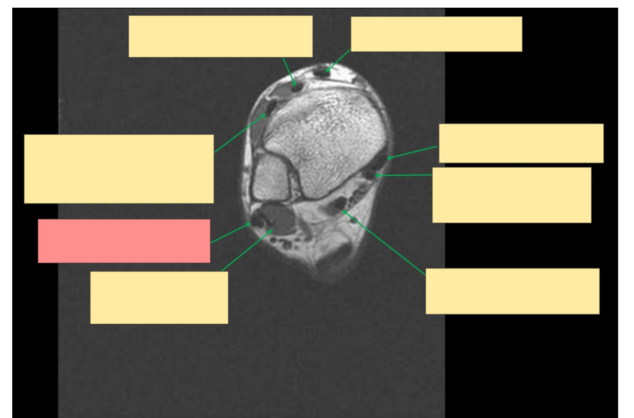 <p>Identify the structure</p>