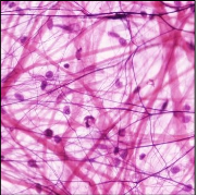 <p>Fibroblasts, collagen, elastic, and reticular fibers in matrix</p><p>Connects tissues and organs</p><p>Papillary layer in dermis of skin</p><p>Allows space for edema</p><p></p>
