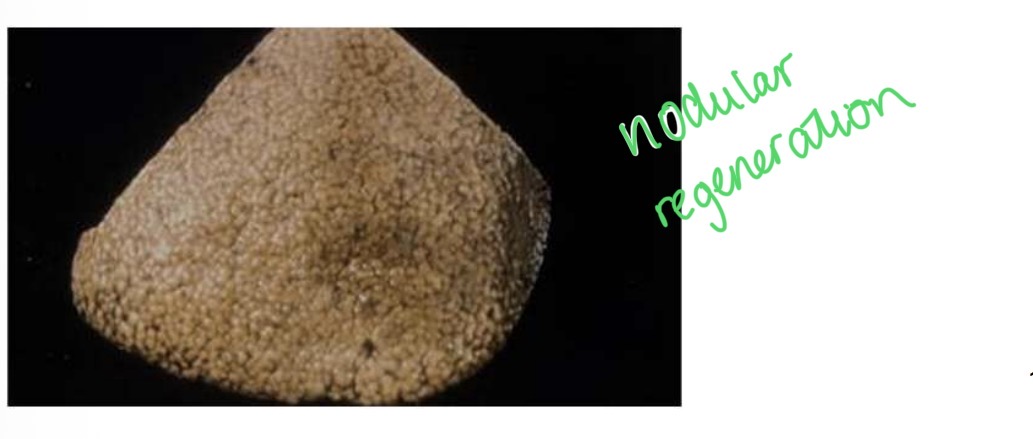 <p>familial copper toxicosis - effects</p>