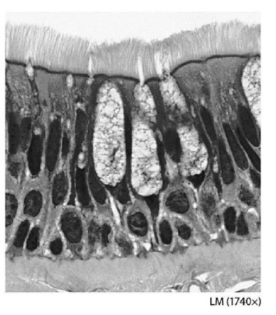 <p>the tissue pictured in this figure is</p>