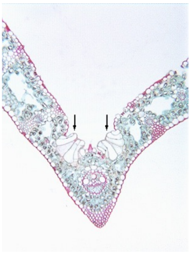 <p>What is this and what is it generally a sign of and what’s the function? </p>