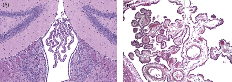 <p>Ependymal cells, makes CSF, found in ventricles</p>