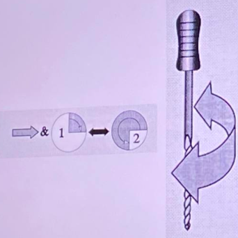 <p>by james b. roane 1985</p><p>inward pressure and rotating force should always be very light.</p><p><span style="color: red;">stepwise motion:</span> push → <span style="color: red;">quarter turn to the right</span> → push-pull → then turn<span style="color: red;"> ¾ counterclockwise</span></p><p>maintains canal curvature, safe in curved canals,<span style="color: red;"> reduces foramen transportation</span> due to the balanced forces</p><ul><li><p><strong>technique steps:</strong></p><ul><li><p>with <span style="color: red;">apical pressure</span>, perform a <span style="color: red;">¼ turn clockwise</span> </p></li><li><p>again with apical pressure, perform a<span style="color: red;"> ¾ turn counter</span>clockwise.</p></li><li><p>if done properly, a <span style="color: red;">“click” </span>is heard when the instrument cuts dentin.</p></li><li><p>repeat sequence <span style="color: red;">2–3 times</span>.</p></li></ul></li></ul><p></p>