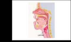 <p>High-pitched inspiratory sound heard over the upper airway, indicating obstruction.</p>