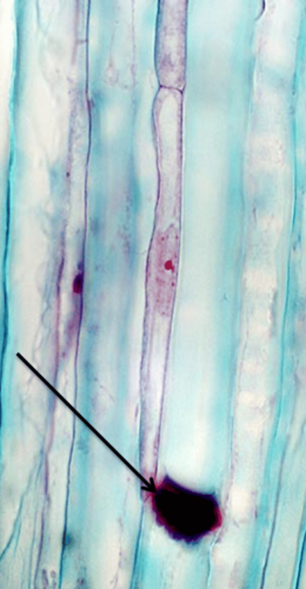 <p>A physical plant defence that is a polysaccharide deposited in sieve tube elements to block the phloem, preventing the spread of infection around the plant</p>