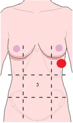 <p>identify the region of the abdomen:</p>