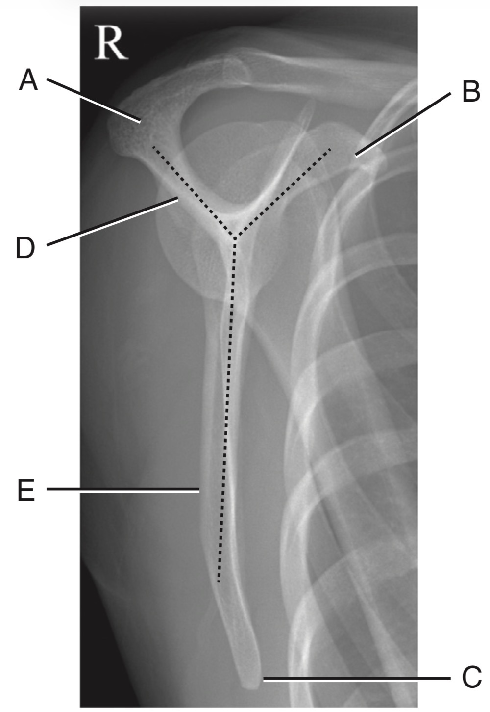 <p>C</p>