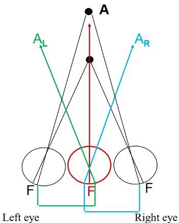 <p><strong>Uncrossed </strong>diplopea. </p><p>object is <strong>farther </strong>than fixation —> image on nasal retina of both eyes. </p><p><em>left eye image appears on left, right eye image appears on right. </em></p><p>Remember - corresponding points will give rise to one nasal and one temporal! </p>