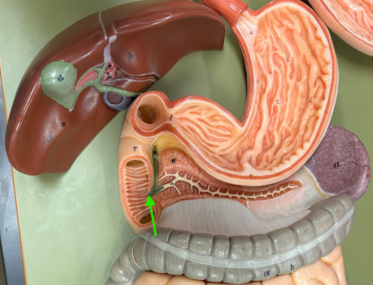 <p>What is the arrow pointing at?</p>