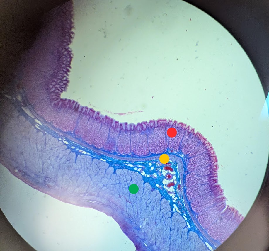 <p>What kind of cells are on the deep purple edge</p>