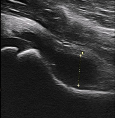 <p>Identify this image. </p>