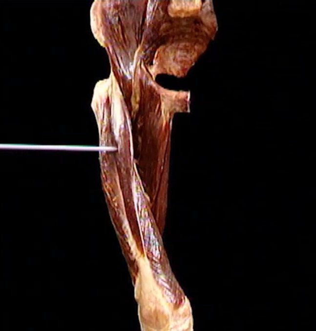 <p>Diep, anterior zicht</p>