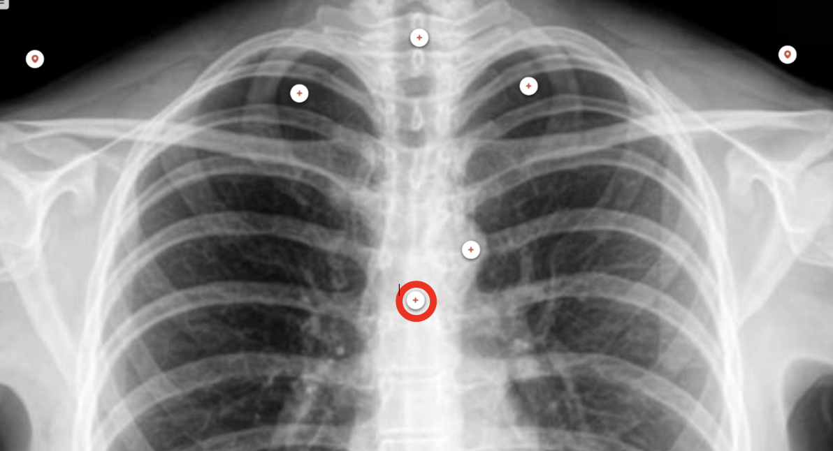 <p>what structure is the red circle labeling?</p>