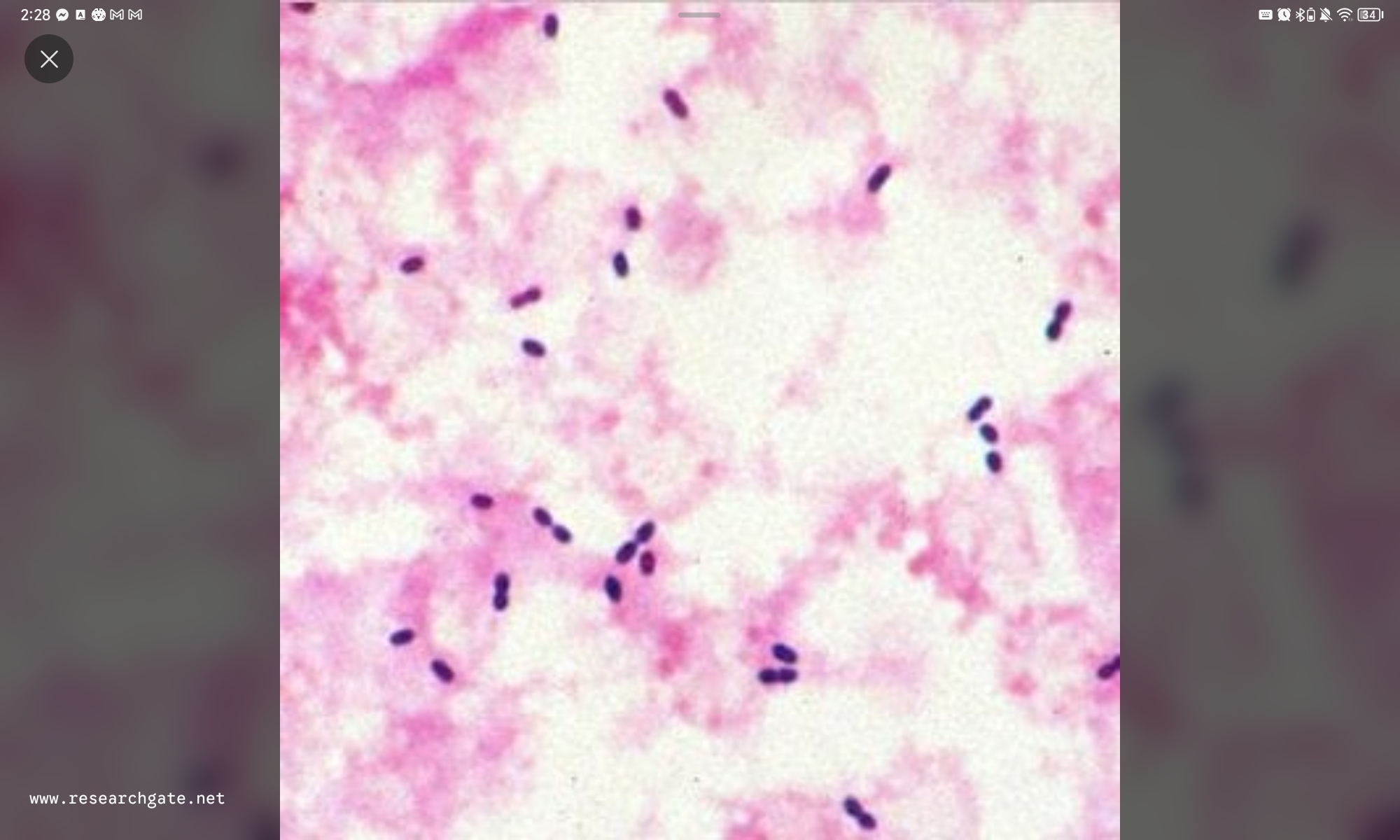 <p>Answer: C. Gram-positive lancet-shaped diplococci</p><p>Rationale:</p><p>A. <span data-name="cross_mark" data-type="emoji">❌</span> N. gonorrhoeae and N. meningitidis are Gram-negative diplococci.</p><p>B. <span data-name="cross_mark" data-type="emoji">❌</span> Grape-like clusters are characteristic of Staphylococcus.</p><p>C. <span data-name="check_mark_button" data-type="emoji">✅</span> S. pneumoniae appears as Gram-positive, lancet-shaped diplococci.</p><p>D. <span data-name="cross_mark" data-type="emoji">❌</span> Tetrads are associated with Micrococcus.</p><p>E. <span data-name="cross_mark" data-type="emoji">❌</span> Pneumococcus is a Gram-positive coccus.</p>