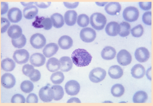 <p>Parasitic protists</p><p>Capable of asexual and sexual reproduction</p><p>Ex. Plasmodium</p>