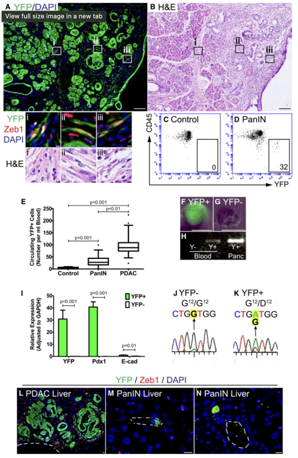 <p>What is CD45 a marker of?</p>