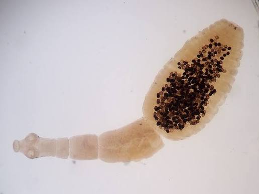 <p>Echinococcus granulosus</p>