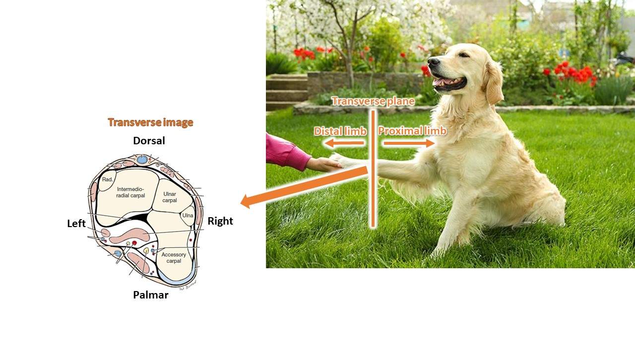 <p>Sagittal plane</p>