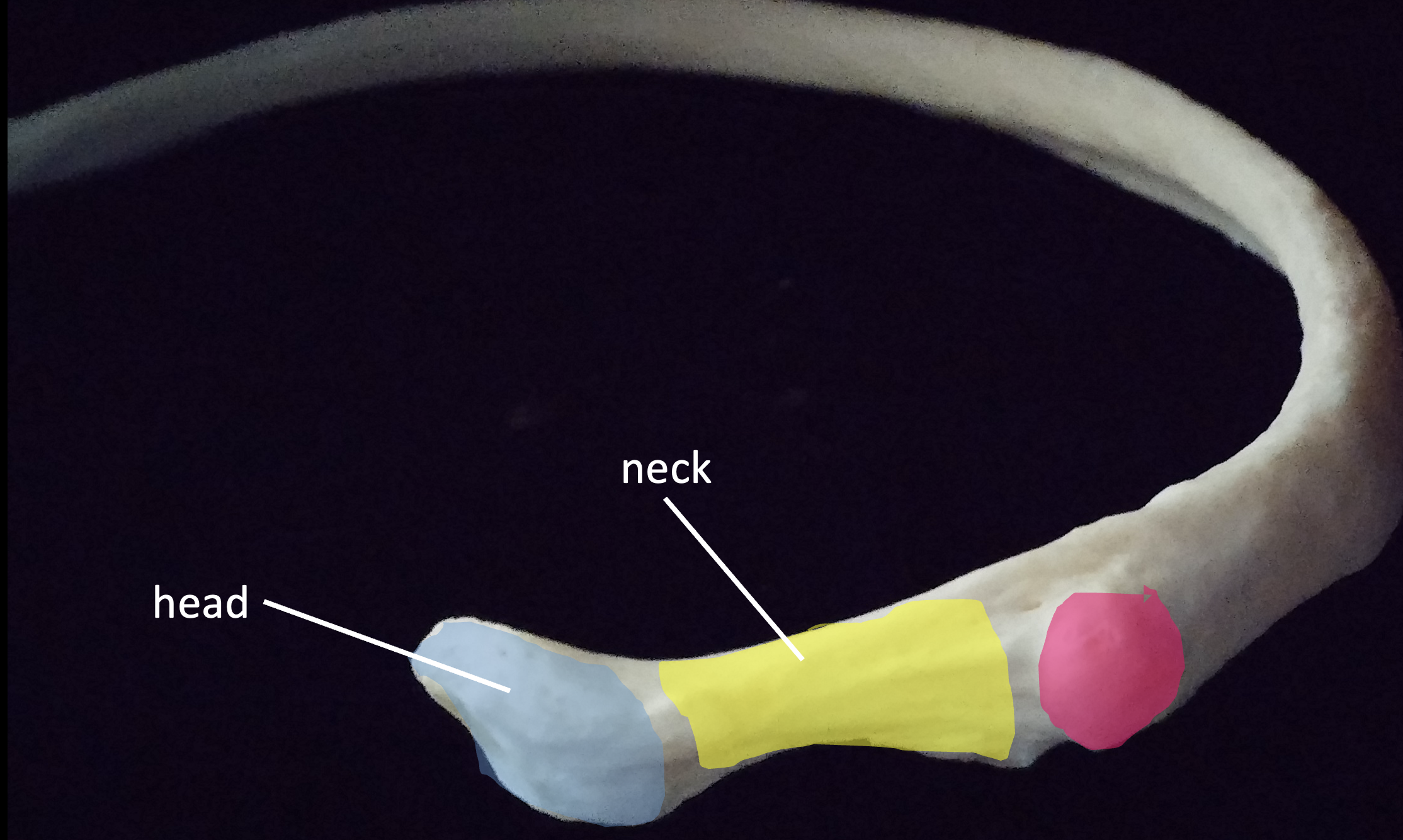 <p>What is the pink region highlighted on the rib?</p>