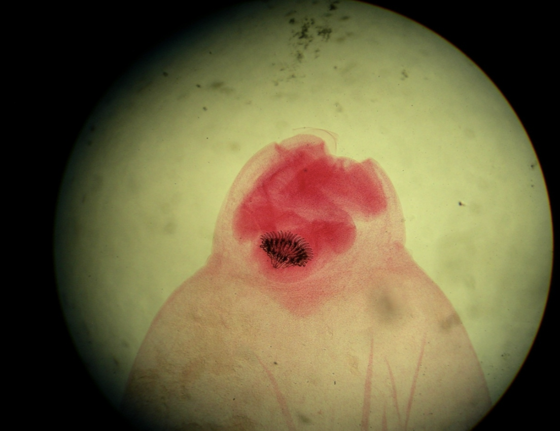 <p>What parasitic worm is this?</p>