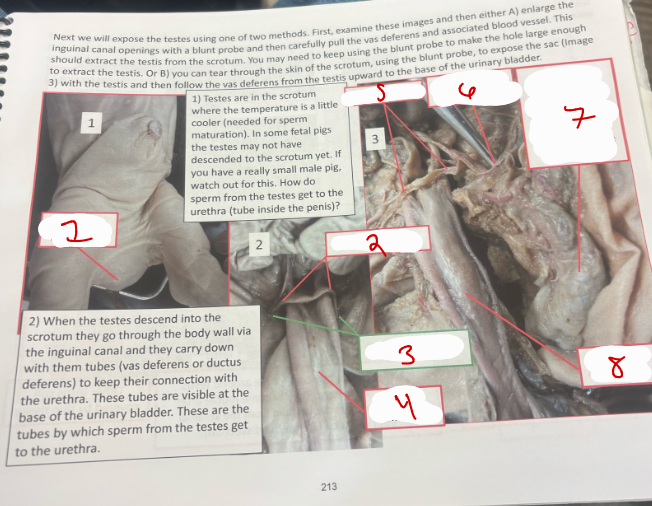 <p>Male Urogenital System 3</p>