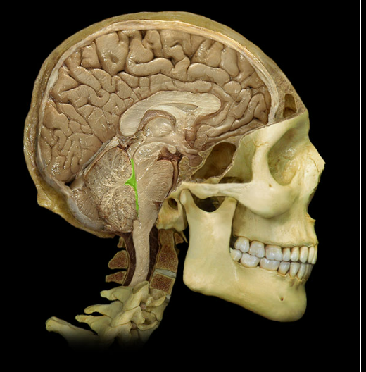 <p><span>Fourth ventricle</span></p>