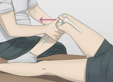 <p>An anterior drawer test (attempting to pull the tibia anteriorly on the femur as pictured below) will most stress which of the following ligaments:</p>