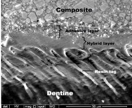 Longitudinal section of dentin tubules