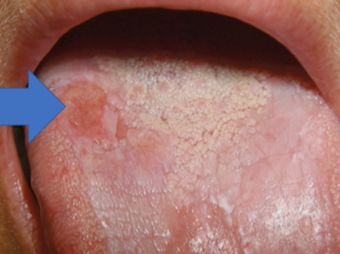 <p>what is this condition</p>