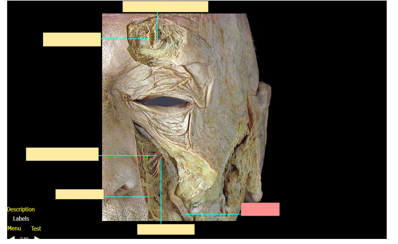 <p>Name this structure</p>