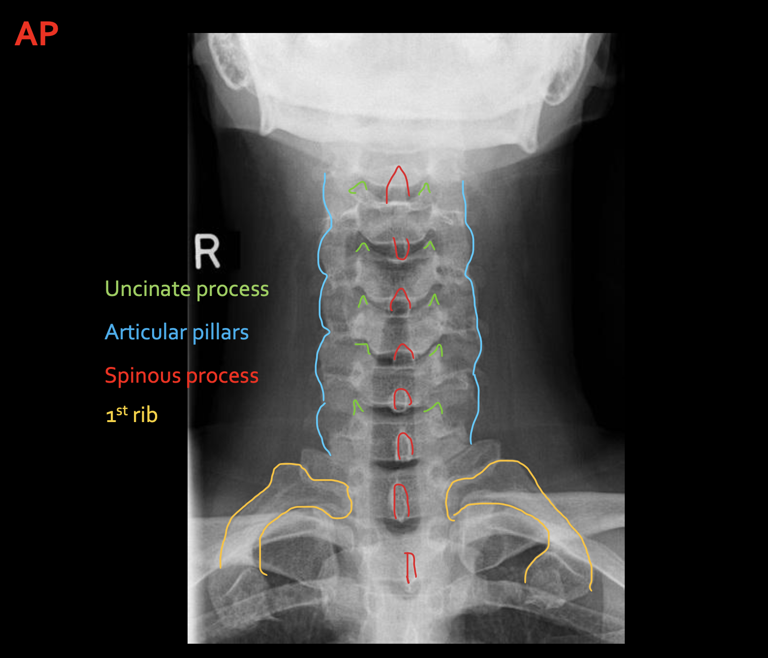 <p><span>Articular pillars</span></p>