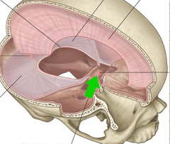 <p>- single layer of dura over the sella turcica with an opening acccomodating the infundibulum of the pituitary gland</p>